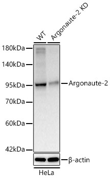 Western blot analysis of lysates from wild type (WT) and Argonaute-2 knockdown (KD) HeLa cells using [KD Validated] Argonaute-2 Rabbit mAb (A25642) at 1:2900 dilution. |Secondary antibody: HRP-conjugated Goat anti-Rabbit IgG (H+L) (AS014)  at 1:10000 dilution.Lysates/proteins: 25 μg per lane.|Blocking buffer: 3% nonfat dry milk in TBST.|Detection: ECL Basic Kit (RM00020).|Exposure time: 30s.