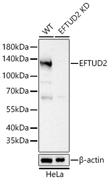 Western blot analysis of lysates from wild type (WT) and EFTUD2 knockdown (KD) HeLa cells using [KD Validated] EFTUD2 Rabbit mAb (A26306) at 1:5000 dilution incubated at room temperature for 1.5 hours.|Secondary antibody: HRP-conjugated Goat anti-Rabbit IgG (H+L) (AS014) at 1:10000 dilution.|Lysates/proteins: 25 μg per lane.|Blocking buffer: 3% nonfat dry milk in TBST.|Detection: ECL Basic Kit (RM00020).|Exposure time: 1s.
