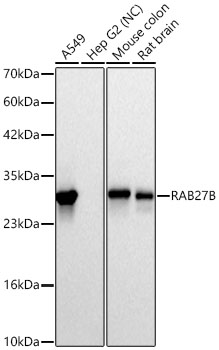 Western blot analysis of various lysates using RAB27B Rabbit mAb at 1:1000 dilution incubated overnight at 4℃.|Secondary antibody: HRP-conjugated Goat anti-Rabbit IgG (H+L) at 1:10000 dilution.|Lysates/proteins: 25 μg per lane.|Blocking buffer: 3% nonfat dry milk in TBST.|Detection: ECL Basic Kit.|Negative control (NC): Hep G2|Exposure time: 10s.