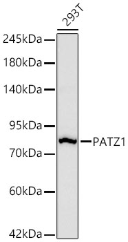 Western blot analysis of lysates from 293T cells using PATZ1 Rabbit mAb at 1:1000 dilution incubated overnight at 4℃.|Secondary antibody: HRP-conjugated Goat anti-Rabbit IgG (H+L) at 1:10000 dilution.|Lysates/proteins: 25 μg per lane.|Blocking buffer: 3% nonfat dry milk in TBST.|Detection: ECL Basic Kit.|Exposure time: 90s.