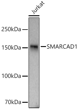 Western blot analysis of lysates from Jurkat cells using SMARCAD1 Rabbit mAb at 1:50000 dilution incubated at room temperature for 1.5 hours.|Secondary antibody: HRP-conjugated Goat anti-Rabbit IgG (H+L) at 1:10000 dilution.|Lysates/proteins: 25 μg per lane.|Blocking buffer: 3% nonfat dry milk in TBST.|Detection: ECL Basic Kit.|Exposure time: 90s.