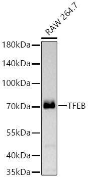 Western blot analysis of lysates from RAW 264.7 cells using [KD Validated] TFEB Rabbit mAb (A25981) at 1:1000 dilution incubated overnight at 4℃.|Secondary antibody: HRP-conjugated Goat anti-Rabbit IgG (H+L) (AS014) at 1:10000 dilution.|Lysates/proteins: 25 μg per lane.|Blocking buffer: 3% nonfat dry milk in TBST.|Detection: ECL Basic Kit (RM00020).|Exposure time: 45s.