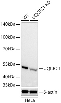 Western blot analysis of lysates from wild type (WT) and UQCRC1 knockdown (KD) HeLa cells using [KD Validated] UQCRC1 Rabbit mAb (A26343) at 1:5000 dilution incubated overnight at 4℃.|Secondary antibody: HRP-conjugated Goat anti-Rabbit IgG (H+L) (AS014) at 1:10000 dilution.|Lysates/proteins: 25 μg per lane.|Blocking buffer: 3% nonfat dry milk in TBST.|Detection: ECL Basic Kit (RM00020).|Exposure time: 10s.