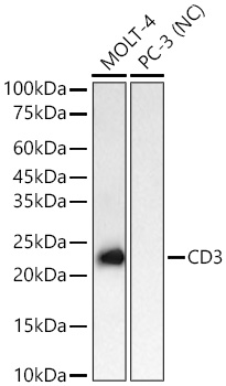 Western blot analysis of various lysates using CD3 Rabbit mAbat 1:1000 dilution incubated overnight at 4℃.|Secondary antibody: HRP-conjugated Goat anti-Rabbit IgG (H+L) at 1:10000 dilution.|Lysates/proteins: 25 μg per lane.|Blocking buffer: 3% nonfat dry milk in TBST.|Detection: ECL Basic Kit.|Negative control (NC): PC-3|Exposure time: 10s.