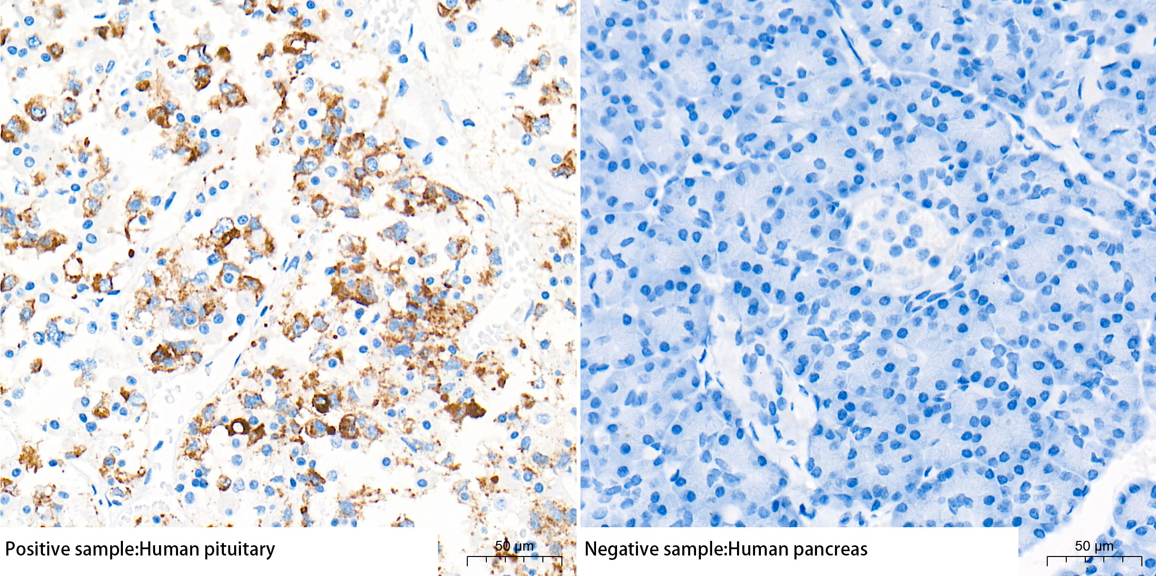 Immunohistochemistry analysis of paraffin-embedded Human pituitary gland(positive sample) and pancreas(negative sample) tissue using PRL/Prolactin Rabbit mAb at a dilution of 1:1000 (40x lens). High pressure antigen retrieval performed with 0.01M Tris-EDTA Buffer (pH 9.0) prior to IHC staining.