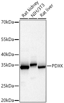Western blot analysis of various lysates using PDXK Rabbit mAb at 1:1000 dilution incubated overnight at 4℃.|Secondary antibody: HRP-conjugated Goat anti-Rabbit IgG (H+L) at 1:10000 dilution.|Lysates/proteins: 25 μg per lane.|Blocking buffer: 3% nonfat dry milk in TBST.|Detection: ECL Basic Kit.|Exposure time: 5s.