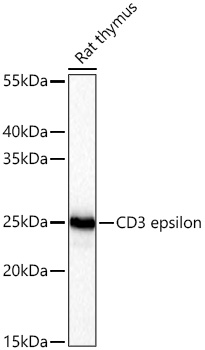 Western blot analysis of lysates from Rat thymus using CD3 epsilon Rabbit mAb at 1:5000 dilution incubated overnight at 4℃.|Secondary antibody: HRP-conjugated Goat anti-Rabbit IgG (H+L) at 1:10000 dilution.|Lysates/proteins: 25 μg per lane.|Blocking buffer: 3% nonfat dry milk in TBST.|Detection: ECL Basic Kit.|Exposure time: 10s.