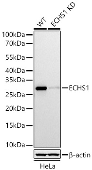 Western blot analysis of lysates from wild type (WT) and ECHS1 knockdown (KD) HeLa cells using [KD Validated] ECHS1 Rabbit mAb (A27295) at 1:2000 dilution incubated overnight at 4℃.|Secondary antibody: HRP-conjugated Goat anti-Rabbit IgG (H+L) (AS014) at 1:10000 dilution.|Lysates/proteins: 25 μg per lane.|Blocking buffer: 3% nonfat dry milk in TBST.|Detection: ECL Basic Kit (RM00020).|Exposure time: 0.8s.