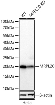 Western blot analysis of lysates from wild type (WT) and MRPL20 knockdown (KD) HeLa cells using [KD Validated] MRPL20 Rabbit mAb (A26199) at 1:2000 dilution incubated overnight at 4℃.|Secondary antibody: HRP-conjugated Goat anti-Rabbit IgG (H+L) (AS014) at 1:10000 dilution.|Lysates/proteins: 25 μg per lane.|Blocking buffer: 3% nonfat dry milk in TBST.|Detection: ECL Basic Kit (RM00020).|Exposure time: 1s.