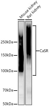 Western blot analysis of various lysates using CaSR Rabbit mAb at 1:5000 dilution incubated overnight at 4℃.|Secondary antibody: HRP-conjugated Goat anti-Rabbit IgG (H+L) at 1:10000 dilution.|Lysates/proteins: 25 μg per lane.|Blocking buffer: 3% nonfat dry milk in TBST.|Detection: ECL Basic Kit.|Exposure time: 60s.