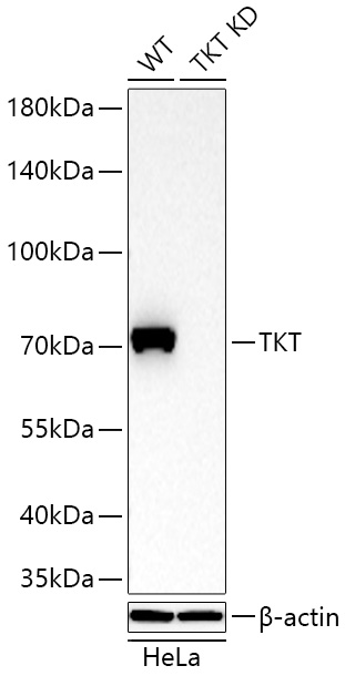 Western blot analysis of lysates from wild type (WT) and TKT knockdown (KD) HeLa cells using [KD Validated] TKT/Transketolase Rabbit mAb (A27144) at 1:13000 dilution incubated overnight at 4℃.|Secondary antibody: HRP-conjugated Goat anti-Rabbit IgG (H+L) (AS014) at 1:10000 dilution.|Lysates/proteins: 25 μg per lane.|Blocking buffer: 3% nonfat dry milk in TBST.|Detection: ECL Basic Kit (RM00020).|Exposure time: 45s.