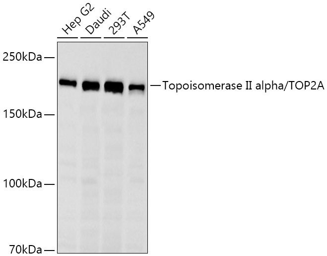 Western blot analysis of various lysates using Topoisomerase II alpha/TOP2A Rabbit mAb (A26497) at 1:1000 dilution incubated overnight at 4℃.|Secondary antibody: HRP-conjugated Goat anti-Rabbit IgG (H+L) (AS014) at 1:10000 dilution.|Lysates/proteins: 25 μg per lane.|Blocking buffer: 3% nonfat dry milk in TBST.|Detection: ECL Basic Kit (RM00020).|Exposure time: 30s.