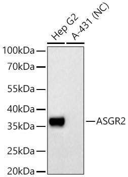 Western blot analysis of various lysates using ASGR2 Rabbit mAbat 1:5000 dilution incubated overnight at 4℃.|Secondary antibody: HRP-conjugated Goat anti-Rabbit IgG (H+L) at 1:10000 dilution.|Lysates/proteins: 25 μg per lane.|Blocking buffer: 3% nonfat dry milk in TBST.|Detection: ECL Basic Kit.|Negative control (NC): A-431|Exposure time: 20s.