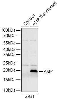 Western blot analysis of lysates from wild type (WT) and 293T cells transfected with ASIP   using ASIP Rabbit mAb at 1:12000 dilution incubated overnight at 4℃.|Secondary antibody: HRP-conjugated Goat anti-Rabbit IgG (H+L) at 1:10000 dilution.|Lysates/proteins: 20 μg per lane.|Blocking buffer: 3% nonfat dry milk in TBST.|Detection: ECL Basic Kit.|Exposure time: 45s.