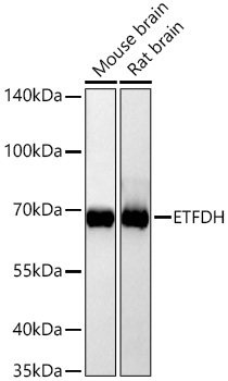 Western blot analysis of various lysates using [KD Validated] ETFDH Rabbit mAb (A26878) at 1:63000 dilution incubated overnight at 4℃.|Secondary antibody: HRP-conjugated Goat anti-Rabbit IgG (H+L) (AS014) at 1:10000 dilution.|Lysates/proteins: 25 μg per lane.|Blocking buffer: 3% nonfat dry milk in TBST.|Detection: ECL Basic Kit (RM00020).|Exposure time: 10s.