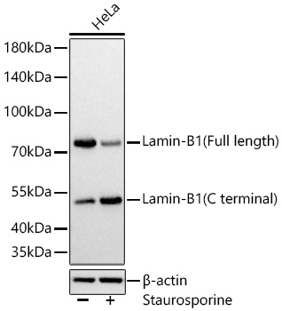 Western blot analysis of lysates from HeLa cells using Lamin-B1 Rabbit mAb at 1:25000 dilution incubated overnight at 4℃. HeLa cells were treated by Staurosporine(1 μM) for 3 hour. | Secondary antibody: HRP-conjugated Goat anti-Rabbit IgG (H+L) at 1:10000 dilution.|Lysates/proteins: 30 μg per lane.| Blocking buffer: 3 % nonfat dry milk in TBST.| Detection: ECL Basic Kit.| Exposure time: 1s.