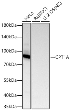 Western blot analysis of various lysates using CPT1A Rabbit mAb at 1:13000 dilution incubated overnight at 4℃.|Secondary antibody: HRP-conjugated Goat anti-Rabbit IgG (H+L) at 1:10000 dilution.|Lysates/proteins: 25 μg per lane.|Blocking buffer: 3% nonfat dry milk in TBST.|Detection: ECL Basic Kit.|Negative control (NC): Raji,U-2 OS|Exposure time: 90s.