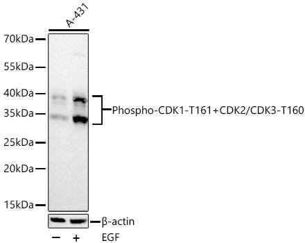 Western blot analysis of lysates from A-431 cells using Phospho-CDK1-T161+CDK2/CDK3-T160 Rabbit mAb at 1:19000 dilution incubated overnight at 4℃.  A-431 cells were treated with EGF (100 ng/mL) at 37℃ for 30 minutes after serum-starvation overnight.|Secondary antibody: HRP-conjugated Goat anti-Rabbit IgG (H+L) at 1:10000 dilution.|Lysates/proteins: 30 μg per lane.| Blocking buffer: 3% nonfat dry milk in TBST.| Detection: ECL Basic Kit.| Exposure time: 90 s.
