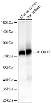 Western blot analysis of various lysates using ALOX12 Rabbit mAb (A27652) at 1:13000 dilution incubated overnight at 4℃.|Secondary antibody: HRP-conjugated Goat anti-Rabbit IgG (H+L) (AS014) at 1:10000 dilution.|Lysates/proteins: 25 μg per lane.|Blocking buffer: 3% nonfat dry milk in TBST.|Detection: ECL Basic Kit (RM00020).|Exposure time: 5s.