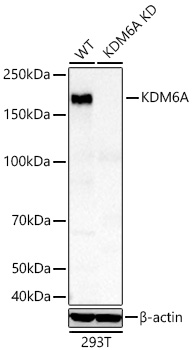 Western blot analysis of lysates from wild type (WT) and KDM6A knockdown (KD) 293T cells using [KD Validated] KDM6A Rabbit mAb (A27546) at 1:12000 dilution incubated overnight at 4℃.|Secondary antibody: HRP-conjugated Goat anti-Rabbit IgG (H+L) (AS014) at 1:10000 dilution.|Lysates/proteins: 25 μg per lane.|Blocking buffer: 3% nonfat dry milk in TBST.|Detection: ECL Basic Kit (RM00020).|Exposure time: 10s.