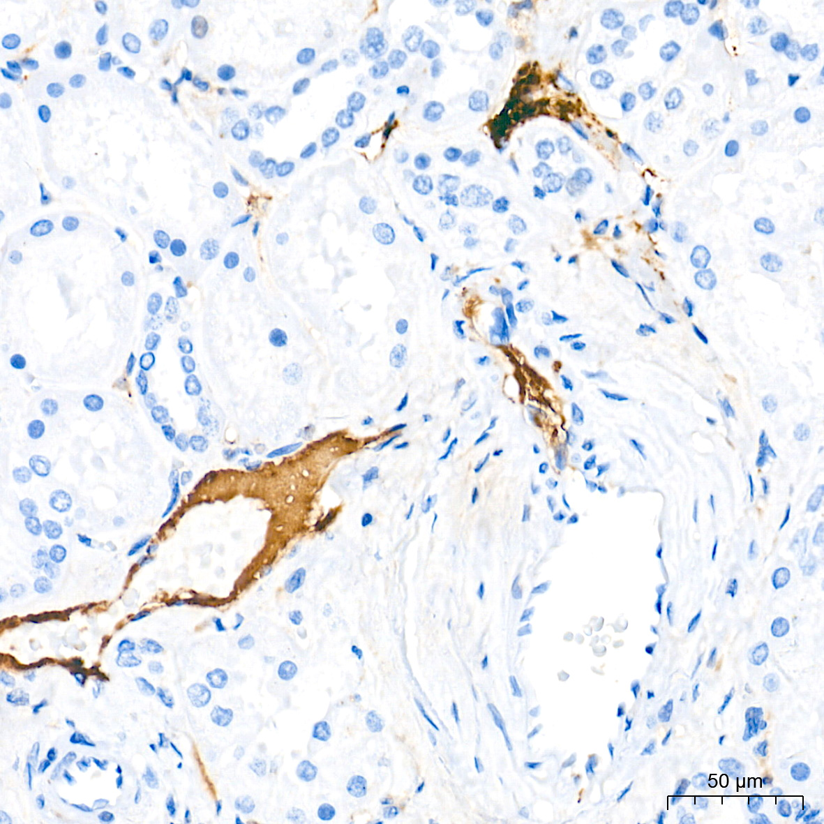 Immunohistochemistry analysis of paraffin-embedded Human kidney tissue using APOB Rabbit mAb at a dilution of 1:5000 (40x lens). High pressure antigen retrieval performed with 0.01M Tris-EDTA Buffer (pH 9.0) prior to IHC staining.