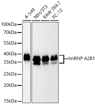 Western blot analysis of various lysates using [KD Validated] hnRNP A2B1 Rabbit mAb (A27189) at 1:13000 dilution incubated overnight at 4℃.|Secondary antibody: HRP-conjugated Goat anti-Rabbit IgG (H+L) (AS014) at 1:10000 dilution.|Lysates/proteins: 25 μg per lane.|Blocking buffer: 3% nonfat dry milk in TBST.|Detection: ECL Basic Kit (RM00020).|Exposure time: 10s.