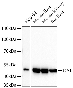 Western blot analysis of various lysates using [KD Validated] OAT Rabbit mAb (A27191) at 1:11000 dilution incubated at room temperature for 1.5 hours.|Secondary antibody: HRP-conjugated Goat anti-Rabbit IgG (H+L) (AS014) at 1:10000 dilution.|Lysates/proteins: 25 μg per lane.|Blocking buffer: 3% nonfat dry milk in TBST.|Detection: ECL Basic Kit (RM00020).|Exposure time: 20s.