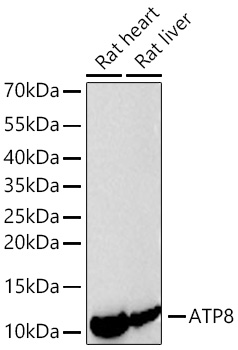 Western blot analysis of various lysates using ATP8 Rabbit mAb at 1:12000 dilution incubated at room temperature for 1.5 hours.|Secondary antibody: HRP-conjugated Goat anti-Rabbit IgG (H+L) at 1:10000 dilution.|Lysates/proteins: 25 μg per lane.|Blocking buffer: 3% nonfat dry milk in TBST.|Detection: ECL Basic Kit.|Exposure time: 45s.