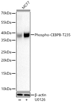 Western blot analysis of lysates from MCF7 cells using Phospho-CEBPB-T235 Rabbit mAb at 1:1000 dilution incubated overnight at 4℃. MCF7 cells were treated with U0126 (20 μM)  for 48 hours.|Secondary antibody: HRP-conjugated Goat anti-Rabbit IgG (H+L) at 1:10000 dilution.|Lysates/proteins: 30 μg per lane.| Blocking buffer: 3% nonfat dry milk in TBST.| Detection: ECL Basic Kit.| Exposure time: 90s.