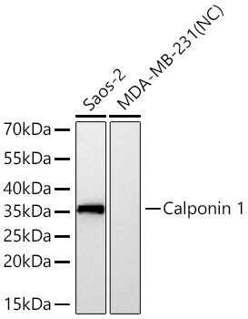 Western blot analysis of various lysates using Calponin 1 Rabbit mAb at 1:5000 dilution incubated at room temperature for 1.5 hours.|Secondary antibody: HRP-conjugated Goat anti-Rabbit IgG (H+L) at 1:10000 dilution.|Lysates/proteins: 25 μg per lane.|Blocking buffer: 3% nonfat dry milk in TBST.|Detection: ECL Basic Kit.|Negative control (NC): MDA-MB-231|Exposure time: 5s.