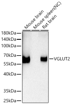 Western blot analysis of various lysates using VGLUT2 Rabbit mAb (A27586) at 1:6000 dilution incubated overnight at 4℃.|Secondary antibody: HRP-conjugated Goat anti-Rabbit IgG (H+L) (AS014) at 1:10000 dilution.|Lysates/proteins: 25 μg per lane.|Blocking buffer: 3% nonfat dry milk in TBST.|Detection: ECL Basic Kit (RM00020).|Negative control (NC): Mouse spleen |Exposure time: 60s.