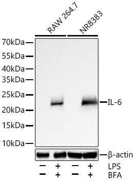 Western blot analysis of various lysates using IL-6 Rabbit mAb at 1:5000 dilution incubated overnight at 4℃. RAW 264.7 cells and NR8383 cells were treated with LPS (1 μg/mL) and BFA (300 ng/mL) for 8 hours.|Secondary antibody: HRP-conjugated Goat anti-Rabbit IgG (H+L) at 1:10000 dilution.|Lysates/proteins: 30 μg per lane.|Blocking buffer: 3% nonfat dry milk in TBST.|Detection: ECL Basic Kit.|Exposure time: 45 s.