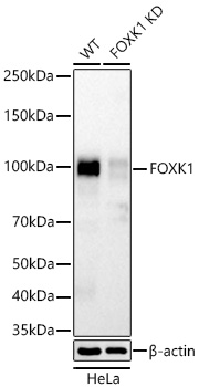 Western blot analysis of lysates from wild type (WT) and FOXK1 knockdown (KD) HeLa cells using [KD Validated] FOXK1 mAb (A27583) at 1:6000 dilution incubated at room temperature for 1.5 hours.|Secondary antibody: HRP-conjugated Goat anti-Rabbit IgG (H+L) (AS014) at 1:10000 dilution.|Lysates/proteins: 25 μg per lane.|Blocking buffer: 3% nonfat dry milk in TBST.|Detection: ECL Basic Kit (RM00020).|Exposure time: 20s.