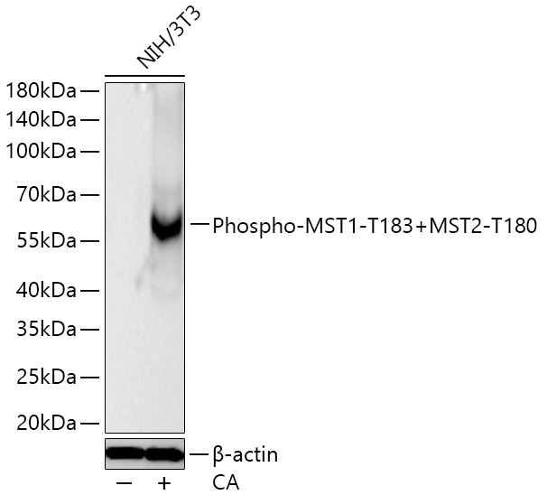 Western blot analysis of lysates from NIH/3T3 cells using Phospho-MST1-T183+MST2-T180 Rabbit mAb at 1:40000 dilution incubated overnight at 4℃. NIH/3T3 cells were treated with Calyculin A (100 nM) at 37℃ for 30 minutes.|Secondary antibody: HRP-conjugated Goat anti-Rabbit IgG (H+L) at 1:10000 dilution.|Lysates/proteins: 30 μg per lane.| Blocking buffer: 3 % nonfat dry milk in TBST.| Detection: ECL Basic Kit.| Exposure time: 20s.