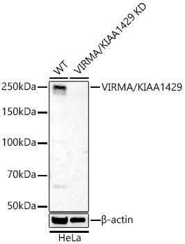 Western blot analysis of lysates from wild type (WT) and VIRMA/KIAA1429 knockdown (KD) HeLa cells using [KD Validated] VIRMA/KIAA1429 Rabbit mAb (A27936) at 1:9000 dilution incubated at room temperature for 1.5 hours.|Secondary antibody: HRP-conjugated Goat anti-Rabbit IgG (H+L) (AS014) at 1:10000 dilution.|Lysates/proteins: 25 μg per lane.|Blocking buffer: 3% nonfat dry milk in TBST.|Detection: ECL Basic Kit (RM00020).|Exposure time: 90s.