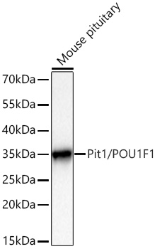 Western blot analysis of various lysates using Pit1/POU1F1 Rabbit mAb at 1:8000 dilution incubated overnight at 4℃.|Secondary antibody: HRP-conjugated Goat anti-Rabbit IgG (H+L) at 1:10000 dilution.|Lysates/proteins: 25 μg per lane.|Blocking buffer: 3% nonfat dry milk in TBST.|Detection: ECL Basic Kit.|Exposure time: 10s.