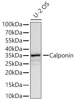 Western blot analysis of lysates from U-2 OS cells using Calponin Rabbit mAb at 1:14000 dilution incubated overnight at 4℃.|Secondary antibody: HRP-conjugated Goat anti-Rabbit IgG (H+L) at 1:10000 dilution.|Lysates/proteins: 25 μg per lane.|Blocking buffer: 3% nonfat dry milk in TBST.|Detection: ECL Basic Kit.|Exposure time: 45s.