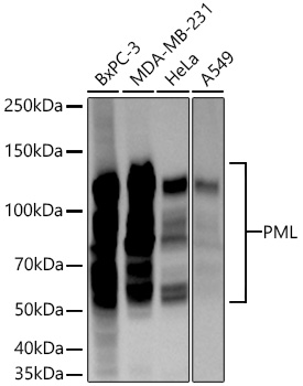 Western blot analysis of various lysates using [KO Validated] PML Rabbit mAb (A27714) at 1:5000 dilution incubated overnight at 4℃.|Secondary antibody: HRP-conjugated Goat anti-Rabbit IgG (H+L) (AS014) at 1:10000 dilution.|Lysates/proteins: 25 μg per lane.|Blocking buffer: 3% nonfat dry milk in TBST.|Detection: ECL Basic Kit (RM00020).|Exposure time: 45s.
