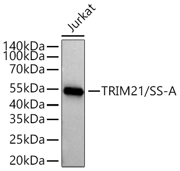 Western blot analysis of lysates from Jurkat cells using [KO Validated] TRIM21/SS-A Rabbit mAb (A27587) at 1:5000 dilution incubated overnight at 4℃.|Secondary antibody: HRP-conjugated Goat anti-Rabbit IgG (H+L) (AS014) at 1:10000 dilution.|Lysates/proteins: 25 μg per lane.|Blocking buffer: 3% nonfat dry milk in TBST.|Detection: ECL Basic Kit (RM00020).|Exposure time: 90s.