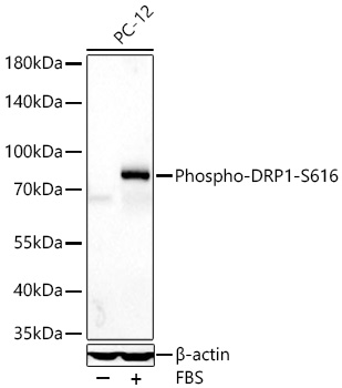 Western blot analysis of lysates from PC-12 cells using Phospho-DRP1-S616 Rabbit mAb at 1:1000 dilution incubated at room temperature for 1.5 hours. PC-12 cells were treated with 10% FBS at 37℃ for 30 minutes after serum-starvation overnight.|Secondary antibody: HRP-conjugated Goat anti-Rabbit IgG (H+L) at 1:10000 dilution.|Lysates/proteins: 30 μg per lane.| Blocking buffer: 3% nonfat dry milk in TBST.| Detection: ECL Basic Kit.| Exposure time: 90s.
