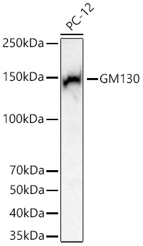 Western blot analysis of lysates from PC-12 cells using [KD Validated] GM130 Rabbit mAb (A27919) at 1:5000 dilution incubated overnight at 4℃.|Secondary antibody: HRP-conjugated Goat anti-Rabbit IgG (H+L) (AS014) at 1:10000 dilution.|Lysates/proteins: 25 μg per lane.|Blocking buffer: 3% nonfat dry milk in TBST.|Detection: ECL Basic Kit (RM00020).|Exposure time: 1s.
