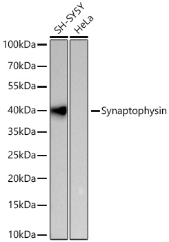 Western blot analysis of various lysates using Synaptophysin Rabbit mAb at 1:5000 dilution incubated overnight at 4℃.|Secondary antibody: HRP-conjugated Goat anti-Rabbit IgG (H+L) at 1:10000 dilution.|Lysates/proteins: 25 μg per lane.|Blocking buffer: 3% nonfat dry milk in TBST.|Detection: ECL Basic Kit.|Negative control (NC): HeLa|Exposure time: 45s.