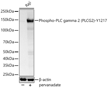 Western blot analysis of lysates from Raji cells using Phospho-PLC gamma 2 (PLCG2)-Y1217 Rabbit mAb at 1:5000 dilution incubated at room temperature for 1.5 hours. Raji cells were treated by pervanadate (1 mM) at 37℃ for 30 minutes after serum-starvation overnight.|Secondary antibody: HRP-conjugated Goat anti-Rabbit IgG (H+L) at 1:10000 dilution.|Lysates/proteins: 30 μg per lane.| Blocking buffer: 3 % nonfat dry milk in TBST.| Detection: ECL Basic Kit.| Exposure time: 1s.