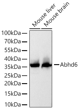 Western blot analysis of various lysates using [KO Validated] Abhd6 Rabbit mAb at 1:5000 dilution incubated overnight at 4℃.|Secondary antibody: HRP-conjugated Goat anti-Rabbit IgG (H+L) at 1:10000 dilution.|Lysates/proteins: 25 μg per lane.|Blocking buffer: 3% nonfat dry milk in TBST.|Detection: ECL Basic Kit.|Exposure time: 20s.