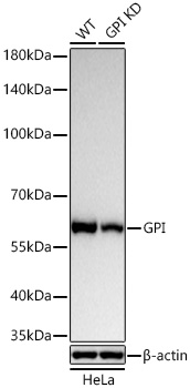 Western blot analysis of lysates from wild type (WT) and GPI knockdown (KD) HeLa cells using [KD Validated] GPI Rabbit mAb (A27679) at 1:6000 dilution incubated at room temperature for 1.5 hours.|Secondary antibody: HRP-conjugated Goat anti-Rabbit IgG (H+L) (AS014) at 1:10000 dilution.|Lysates/proteins: 25 μg per lane.|Blocking buffer: 3% nonfat dry milk in TBST.|Detection: ECL Basic Kit (RM00020).|Exposure time: 5 s.