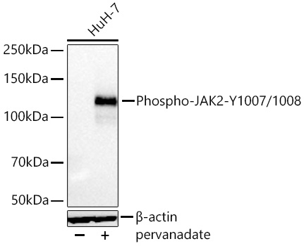 Western blot analysis of lysates from HuH-7 cells using Phospho-JAK2-Y1007/1008 Rabbit mAb at 1:5000 dilution incubated overnight at 4℃. HuH-7 cells were treated with Pervanadate (1 mM) at 37℃ for 30 minutes after serum-starvation overnight.|Secondary antibody: HRP-conjugated Goat anti-Rabbit IgG (H+L) at 1:10000 dilution.|Lysates/proteins: 30 μg per lane.| Blocking buffer: 3 % nonfat dry milk in TBST.| Detection: ECL Basic Kit.| Exposure time: 5s.
