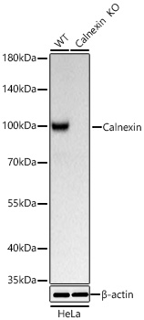 Western blot analysis of lysates from wild type (WT) and Calnexin knockout (KO) HeLa cells using [KO Validated] Calnexin Rabbit mAb (A27819) at 1:5000 dilution incubated at room temperature for 1.5 hours.|Secondary antibody: HRP-conjugated Goat anti-Rabbit IgG (H+L) (AS014) at 1:10000 dilution.|Lysates/proteins: 25 μg per lane.|Blocking buffer: 3% nonfat dry milk in TBST.|Detection: ECL Basic Kit (RM00020).|Exposure time: 1s.