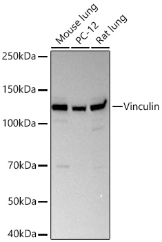 Western blot analysis of various lysates using [KD Validated] Vinculin Rabbit mAb (A27905) at 1:21000 dilution incubated at room temperature for 1.5 hours.|Secondary antibody: HRP-conjugated Goat anti-Rabbit IgG (H+L) (AS014) at 1:10000 dilution.|Lysates/proteins: 25 μg per lane.|Blocking buffer: 3% nonfat dry milk in TBST.|Detection: ECL Basic Kit (RM00020).|Exposure time: 1s.