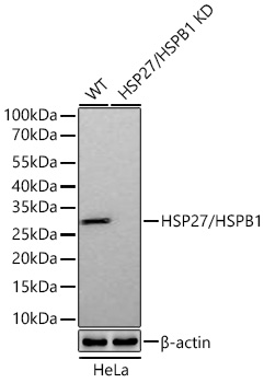 Western blot analysis of lysates from wild type (WT) and HSP27/HSPB1 knockdown (KD) HeLa cells using [KD Validated] HSP27/HSPB1 Rabbit mAb (A27821) at 1:13000 dilution incubated overnight at 4℃.|Secondary antibody: HRP-conjugated Goat anti-Rabbit IgG (H+L) (AS014) at 1:10000 dilution.|Lysates/proteins: 25 μg per lane.|Blocking buffer: 3% nonfat dry milk in TBST.|Detection: ECL Basic Kit (RM00020).|Exposure time: 1s.