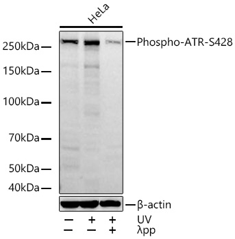Western blot analysis of lysates from HeLa cells using Phospho-ATR-S428 Rabbit mAb at 1:1000 dilution incubated at room temperature for 1.5 hours. HeLa cells were treated with UV at room temperature for 15-30 minutes and λ-pp (1 mM) for 1 hour.|Secondary antibody: HRP-conjugated Goat anti-Rabbit IgG (H+L) at 1:10000 dilution.|Lysates/proteins: 30 μg per lane.| Blocking buffer: 3% nonfat dry milk in TBST.| Detection: ECL Basic Kit.| Exposure time: 45s.